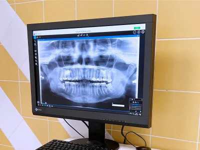 Microscope Treatment